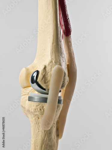 anatomic study model of an human knee replacement