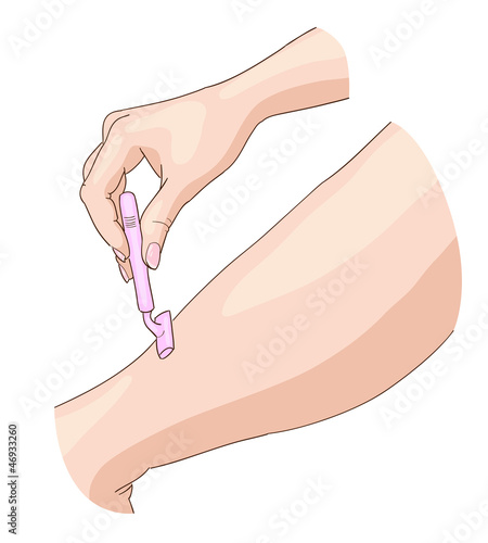 Epilation with razor blade.