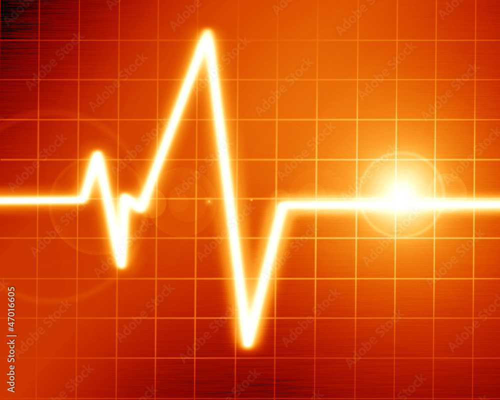 Heart monitor Heart monitor