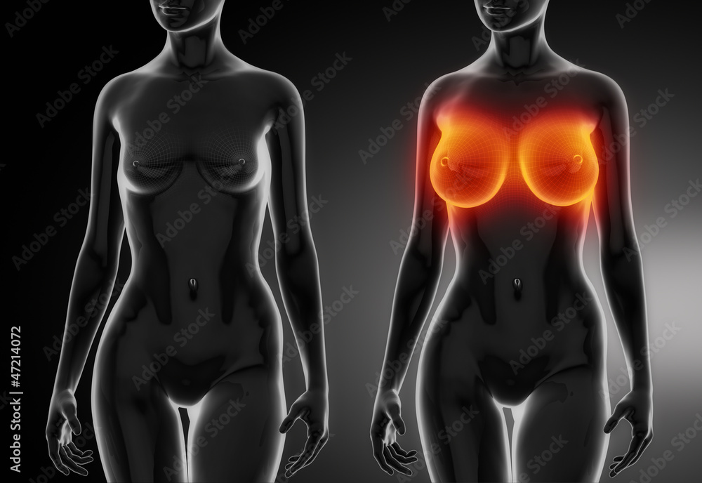 Female breast comparison after plastic surgery Stock Illustration