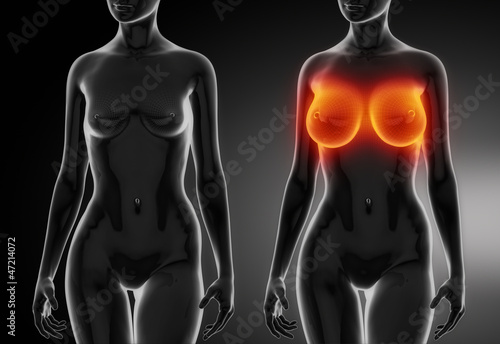 Obraz na płótnie Female breast comparison after plastic surgery