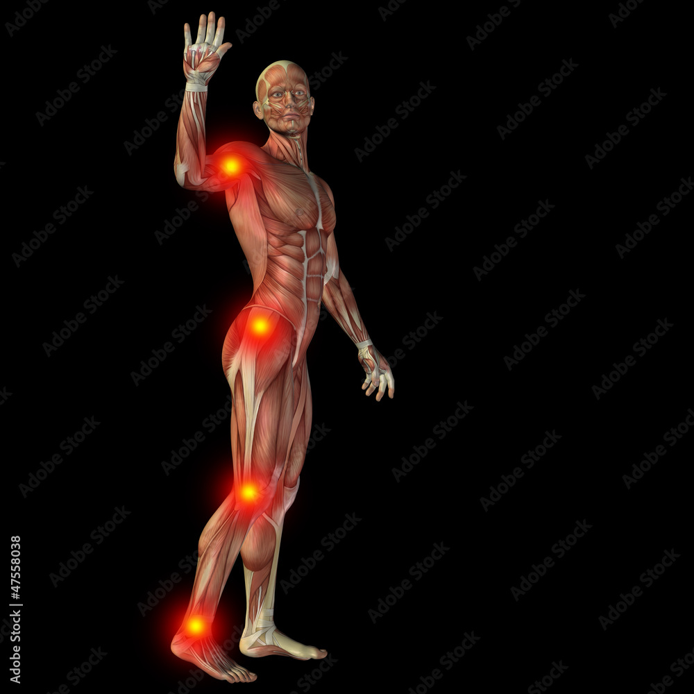 High resolution conceptual 3D human with inflammation High resolution conceptual 3D human with inflammation