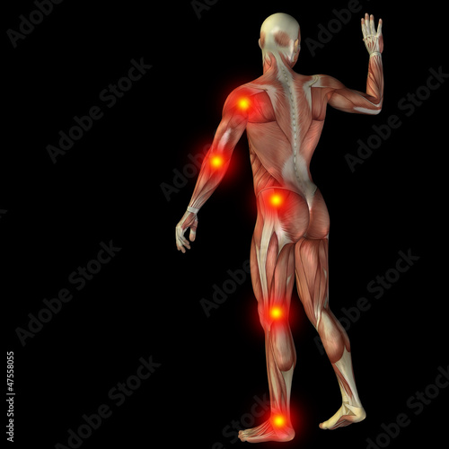 High resolution conceptual 3D human with inflammation