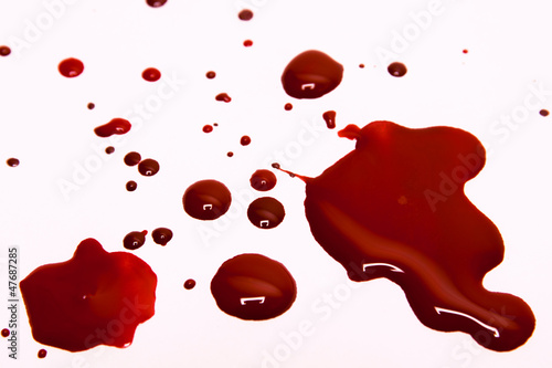 Photos Blood stains