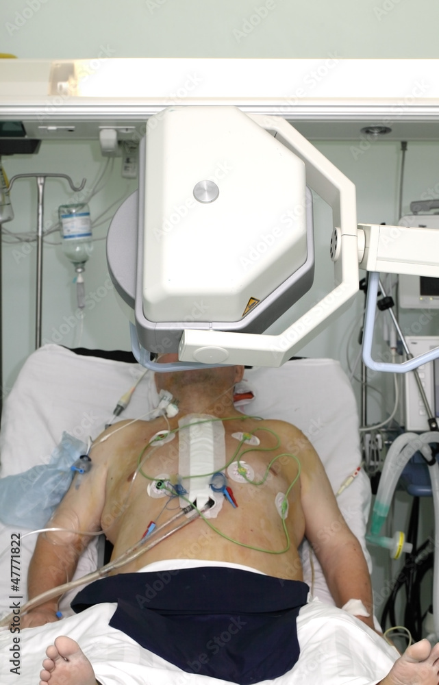 production of X-rays in the ICU production of X-rays in the ICU