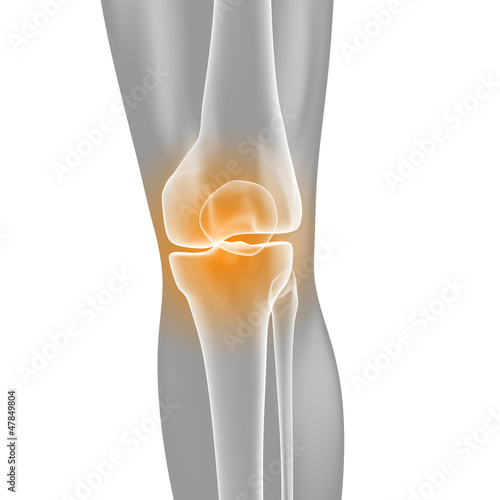 Knie-Schmerzen - Röntgenbild - 3D Grafik