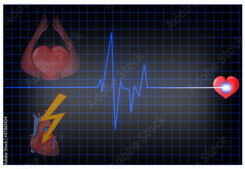 EKG mit Herz