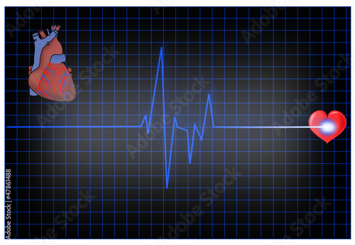 EKG mit Herz