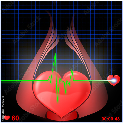 Herz EKG