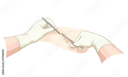 The surgeon takes in a wound.
