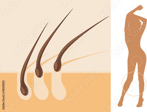 Epilation