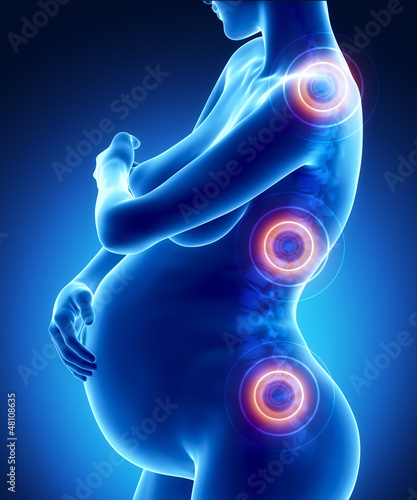 Pregnancy spine problem concept photo