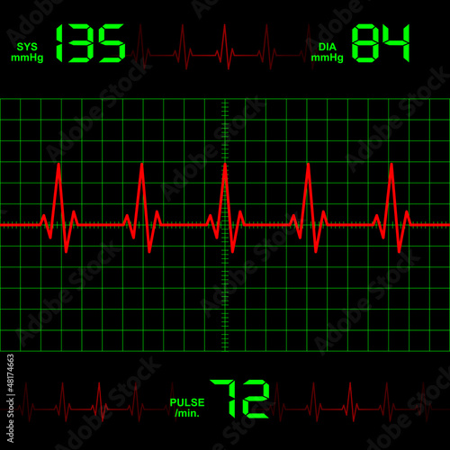 Heart rate