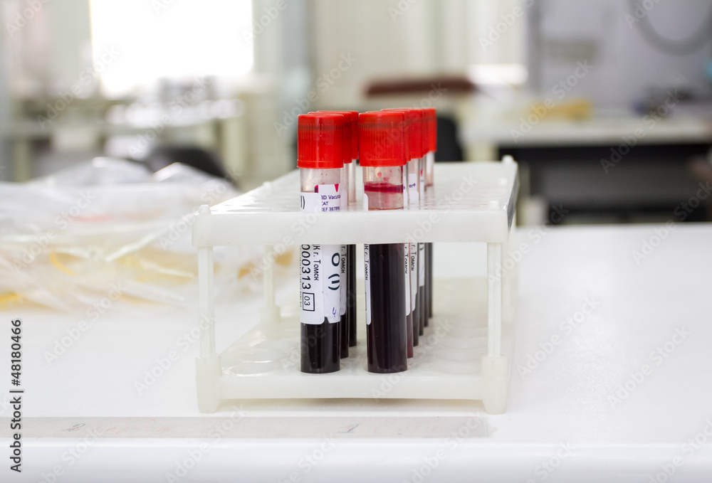 Донорство томск. ВИЧ пробирка. Набор для анализа крови. Пробирки донор крови.