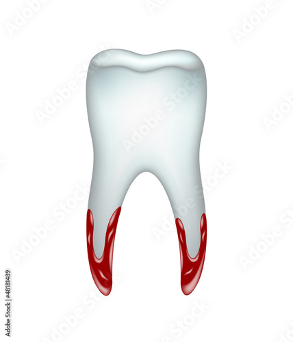 Pulled tooth with blood