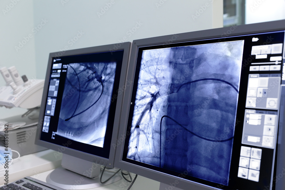 Fototapeta premium Monitor screen in radiology.