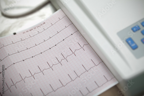 Tableau sur toile Cardiography. Method in medicine.