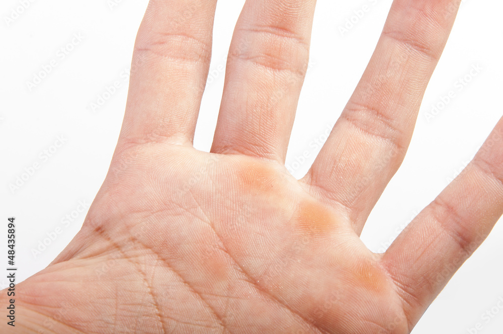 Part of the hand Part of the hand