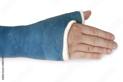 Photography Broken wrist, arm with a blue fiberglass cast on a white backgro