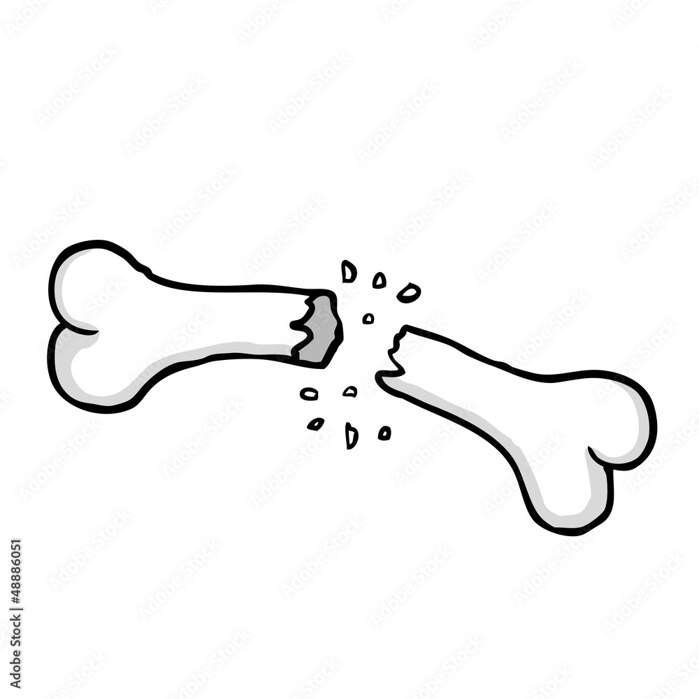 Fototapeta premium Broken bone