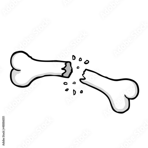 Broken bone
