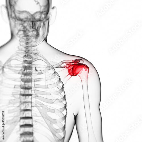 3d rendered illustration of a painful shoulder photo