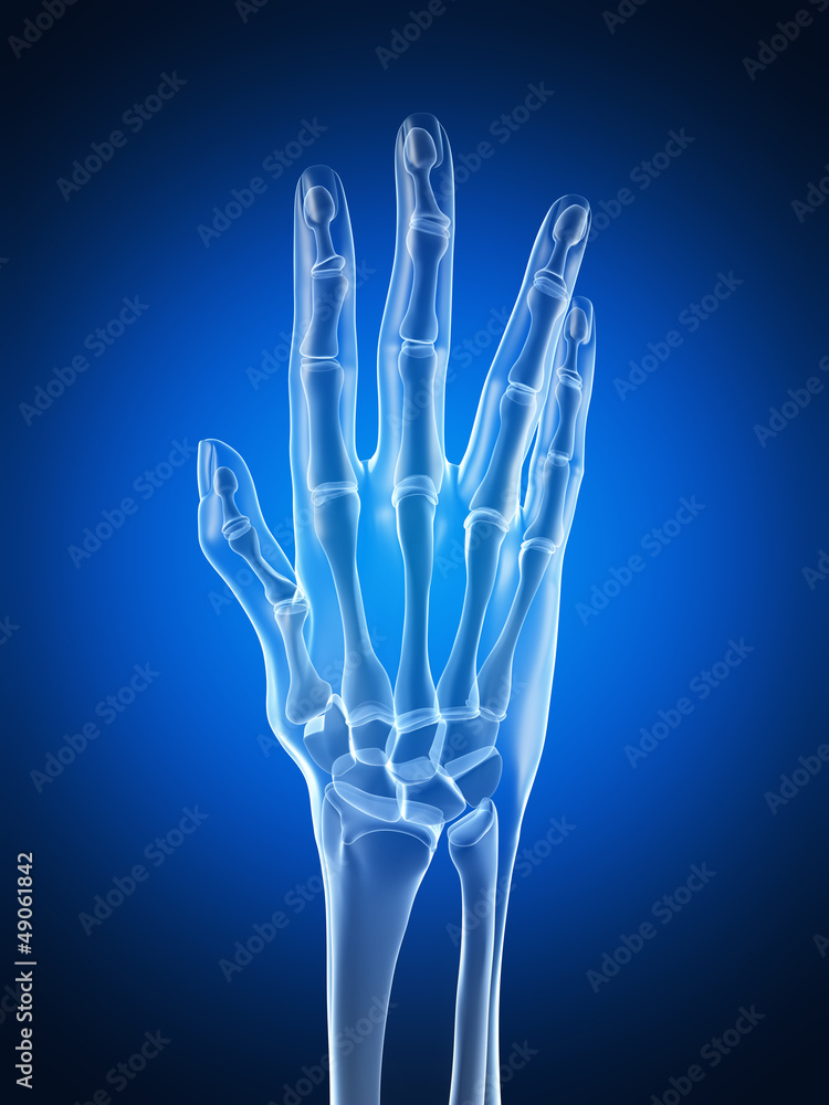 3d rendered illustration of an arthritic hand 3d rendered illustration of an arthritic hand