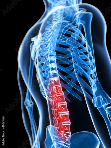 3d rendered illustration of a painful back