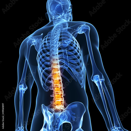 3d rendered illustration of a painful back photo