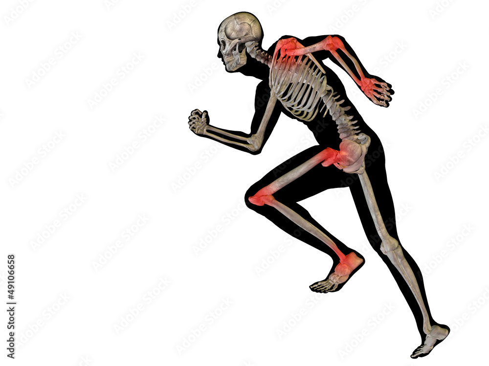 High resolution conceptual 3D human with inflammation High resolution conceptual 3D human with inflammation