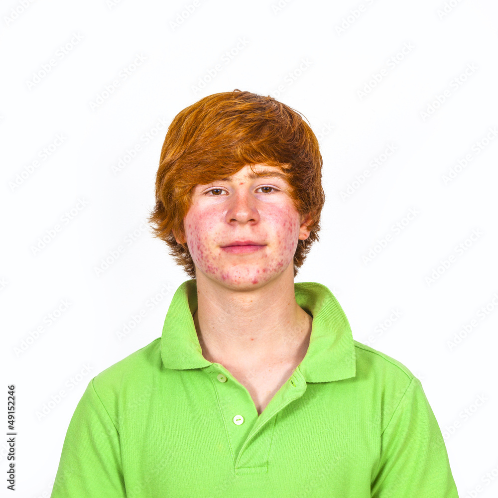 attractive boy in puberty with red hair attractive boy in puberty with red hair