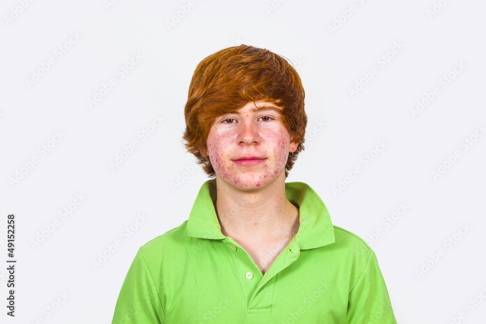attractive boy in puberty with red hair attractive boy in puberty with red hair