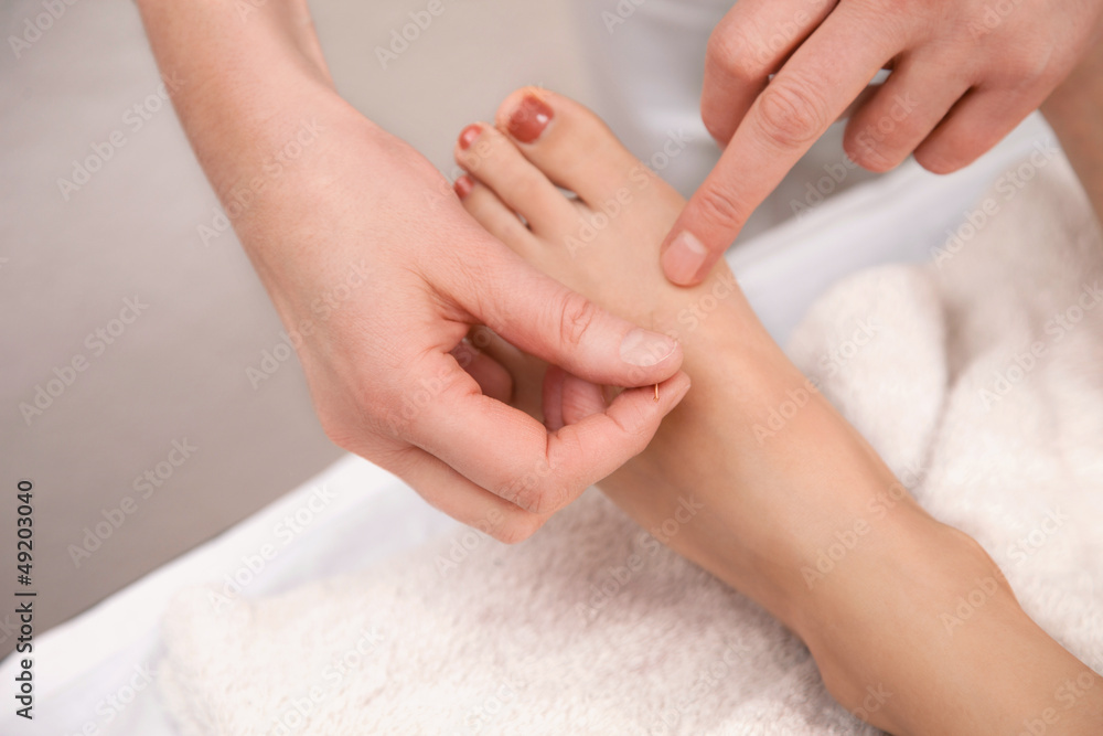 Acupuncture treatment on foot Acupuncture treatment on foot