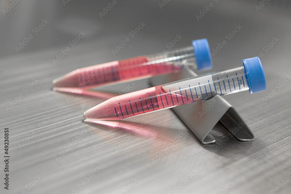 Obraz premium Test-tubes with blood sample in bio lab