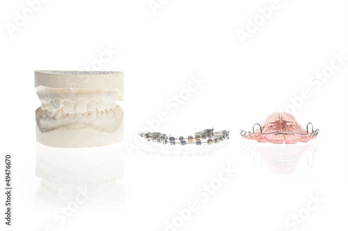 Orthodontics  mould and metal and plastic retainer © KamilJ