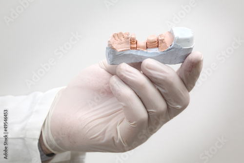 Dentist holding  plaster model of tooth in hand photo