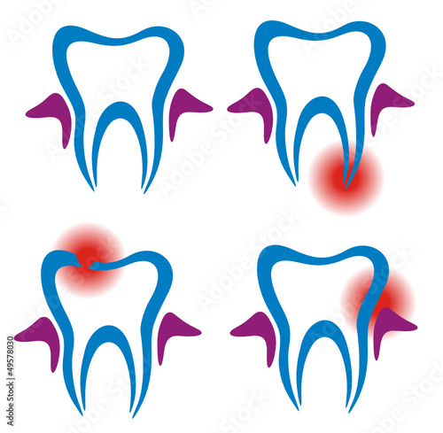 Toothache