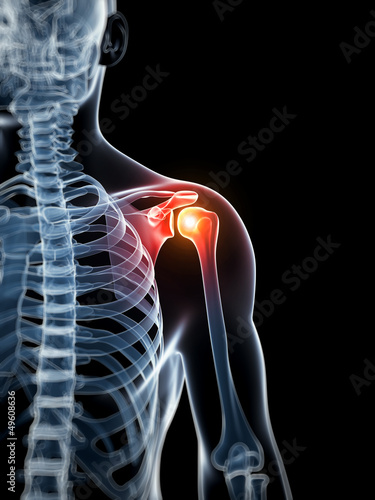 3d rendered illustration - painful shoulder