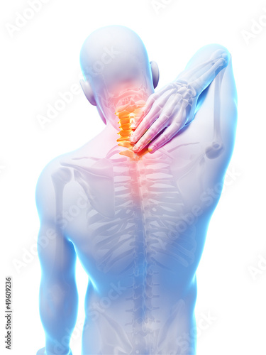 Fototapeta 3d rendered illustration - painful neck