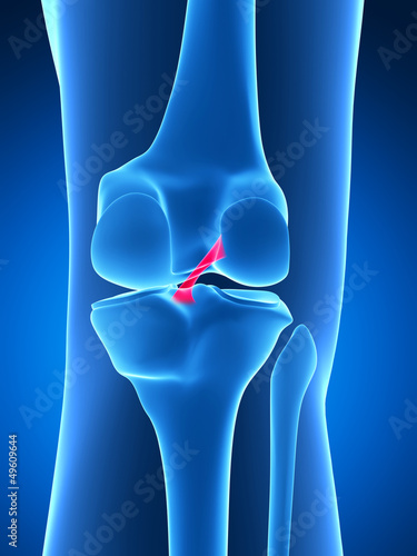 3d rendered illustration - knee anatomy photo