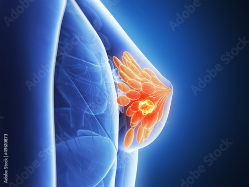 Photography 3d rendered illustration - breast cancer