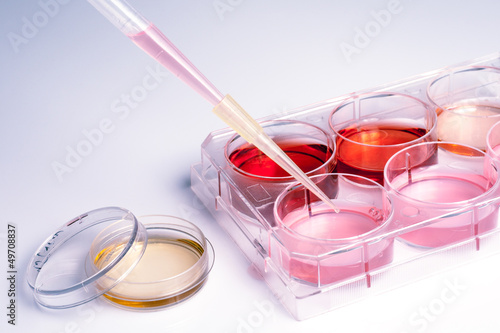 medical laboratory, cells with human blood.