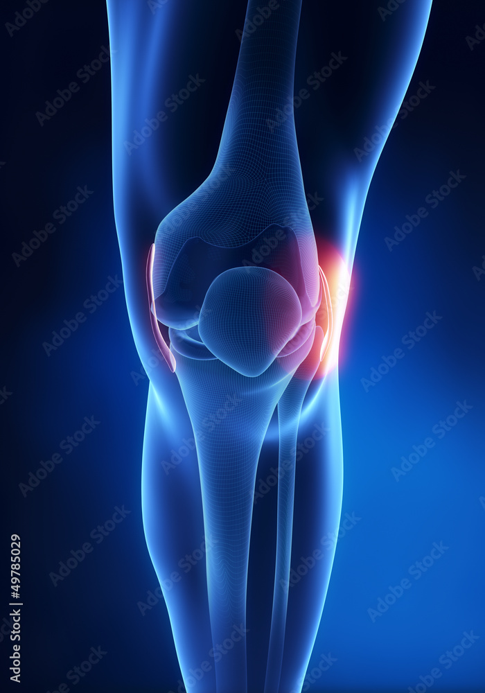 Lateral Collateral Ligament knee injury Lateral Collateral Ligament knee injury