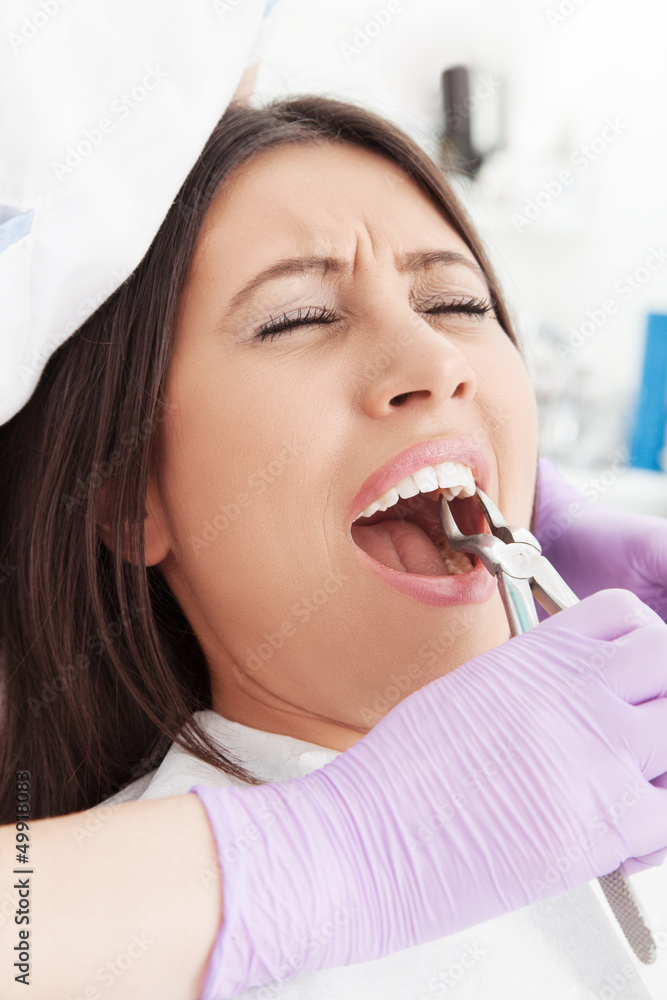 Dentist extracting the tooth Dentist extracting the tooth