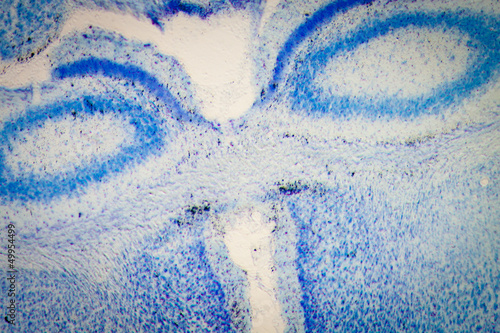 microscopy rat brain hippocampal neurons