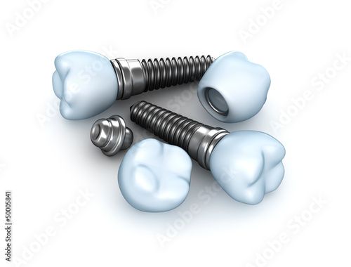 Fototapeta Naklejka Na Ścianę i Meble -  Set of dental implants