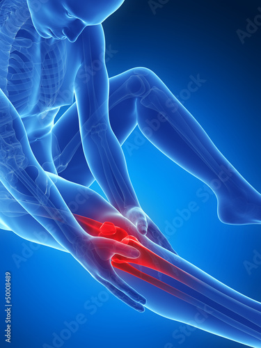 3d rendered illustration of pain in the knee