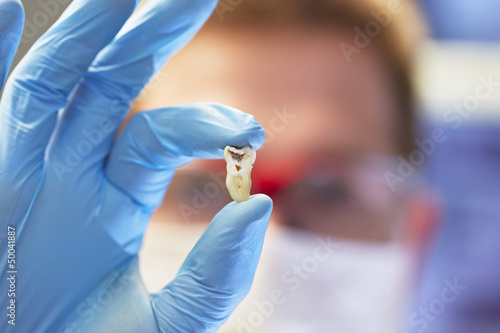 Young dentist is holding tooth - dentist office