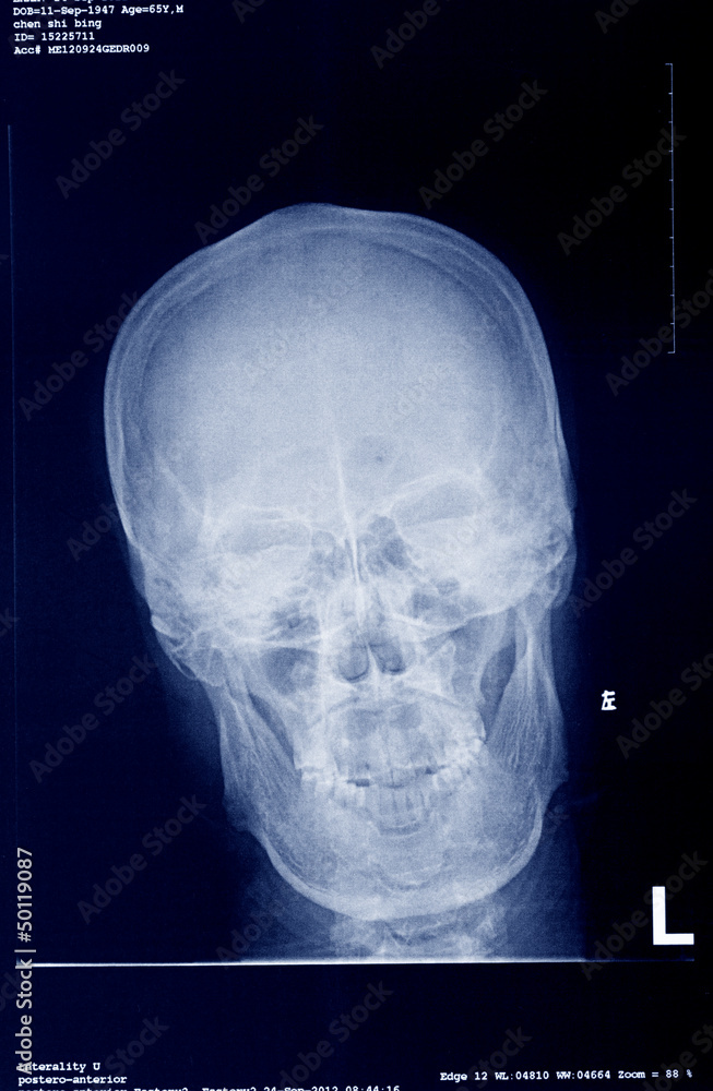 Fototapeta premium medical x-ray film