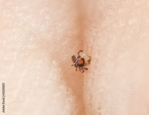 Tick larva feeding on human, extreme close-up